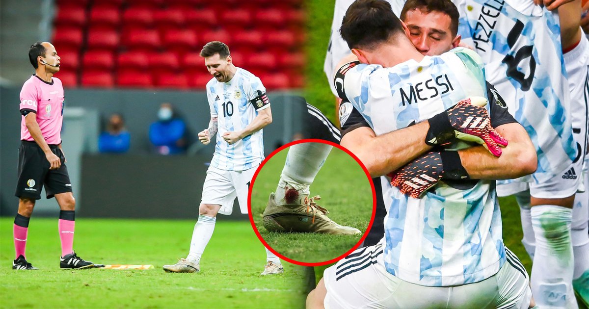 Messi kiên cường thi đấu mặc kệ chấn thương ở trận gặp Colombia